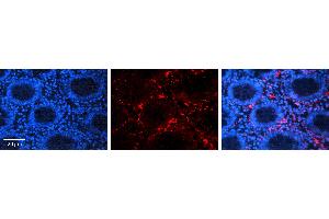 Rabbit Anti-ACTB Antibody   Formalin Fixed Paraffin Embedded Tissue: Human Appendix (Colon) Tissue Observed Staining: Cytoplasm Primary Antibody Concentration: 1:100 Other Working Concentrations: N/A Secondary Antibody: Donkey anti-Rabbit-Cy3 Secondary Antibody Concentration: 1:200 Magnification: 20X Exposure Time: 0.