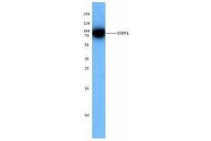 Western Blotting (WB) image for anti-Structure Specific Recognition Protein 1 (SSRP1) antibody (ABIN2666367) (SSRP1 antibody)