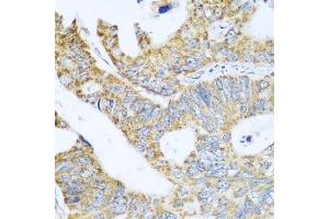 Immunohistochemistry (Paraffin-embedded Sections) (IHC (p)) image for anti-Glutamate Dehydrogenase 1 (GLUD1) (AA 54-240) antibody (ABIN6141157)