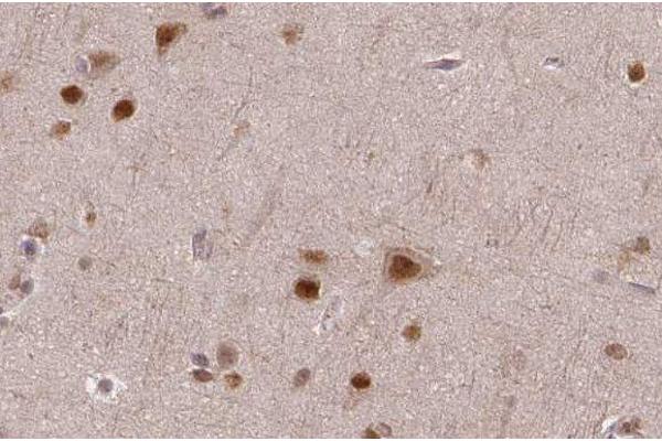 ASPM antibody  (Internal Region)