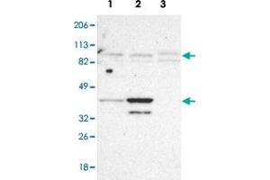 Western blot analysis of Lane 1: RT-4, Lane2: U-251MG sp, Lane 3: Human cell line A-431 with SLMAP polyclonal antibody .