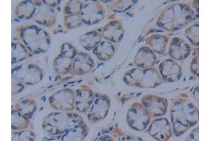 Detection of IkBd in Mouse Intestine Tissue using Polyclonal Antibody to Inhibitory Subunit Of NF Kappa B Delta (IkBd) (IkBd antibody  (AA 58-304))