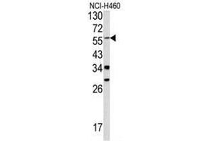 Western blot analysis of YAP1 antibody (C-term) in NCI-H460 cell line lysates (35ug/lane). (YAP1 antibody  (C-Term))