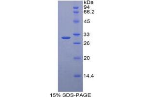 SDS-PAGE analysis of Mouse HGD Protein. (HGD Protein)
