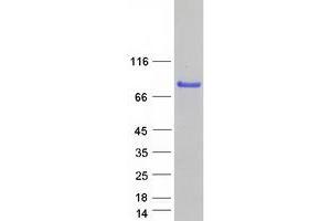 Validation with Western Blot