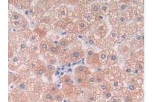Detection of C9 in Human Liver Tissue using Polyclonal Antibody to Complement Component 9 (C9) (C9 antibody  (AA 22-265))
