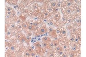 Detection of C9 in Human Liver Tissue using Polyclonal Antibody to Complement Component 9 (C9)