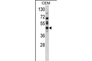 Western blot analysis of USP12 Antibody (N-term) (ABIN388898 and ABIN2839184) in CEM cell line lysates (35 μg/lane). (USP12 antibody  (N-Term))