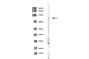 Western blot analysis of lysates from EC304 cells, using APLP2 Antibody at 1/1000 dilution.