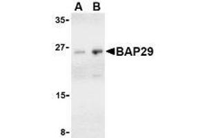 Western blot analysis of Bap29 in human heart tissue lysate with AP30121PU-N Bap29 antibody at (A) 1 and (B) 2 μg/ml. (BCAP29 antibody  (C-Term))