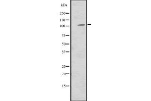 Western blot analysis of MIB2 expression in Hela cell lysate,The lane on the left is treated with the antigen-specific peptide. (MIB2 antibody  (Internal Region))