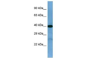 Western Blotting (WB) image for anti-Twinfilin, Actin-Binding Protein, Homolog 2 (Drosophila) (TWF2) (C-Term) antibody (ABIN2784884)