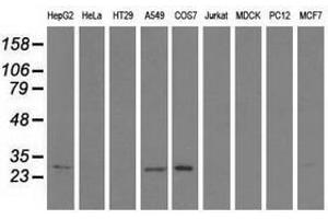 Image no. 2 for anti-Sepiapterin Reductase (SPR) antibody (ABIN1501116) (SPR antibody)