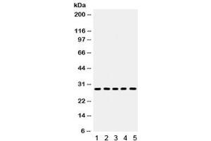 Western blot testing of 1) rat kidney, 2) rat lung, 3) rat heart, 4) rat PC-12 and 5) mouse HEPA lysate with Aquaporin 1 antibody.