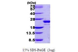 Ubiquitin-Fold Modifier Conjugating Enzyme 1 (UFC1) (AA 1-167) protein (His tag)
