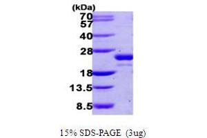 SDS-PAGE (SDS) image for Ubiquitin-Fold Modifier Conjugating Enzyme 1 (UFC1) (AA 1-167) protein (His tag) (ABIN667453)