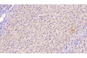 Detection of TFR in Human Liver Tissue using Monoclonal Antibody to Transferrin Receptor (TFR) (Transferrin Receptor antibody  (AA 567-744))