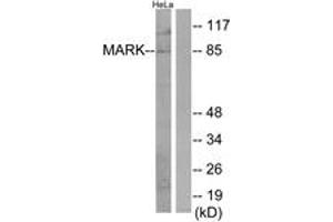 Western Blotting (WB) image for anti-MAP/microtubule Affinity-Regulating Kinase 1/2/3/4 (MARK1/2/3/4) (AA 121-170) antibody (ABIN2889783) (MARK1/2/3/4 antibody  (AA 121-170))