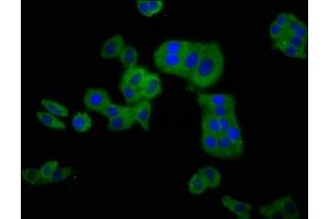 Immunofluorescence staining of HepG2 cells with ABIN7147581 at 1:100, counter-stained with DAPI. (CLCNKB antibody  (AA 538-687))