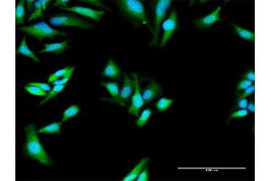 Immunofluorescence of purified MaxPab antibody to MX1 on HeLa cell. (MX1 antibody  (AA 1-662))
