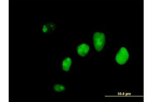 Immunofluorescence of purified MaxPab antibody to IFI16 on HeLa cell.