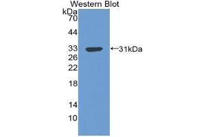 Detection of Recombinant C4BPb, Human using Polyclonal Antibody to C4 Binding Protein Beta (C4BPb) (C4BPB antibody  (AA 18-252))