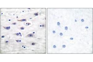 Immunohistochemistry analysis of paraffin-embedded human brain tissue, using GluR1 (Ab-863) Antibody.
