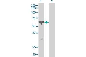 Western Blot analysis of PCTK1 expression in transfected 293T cell line by PCTK1 monoclonal antibody (M02), clone 2E5. (CDK16 antibody  (AA 1-80))