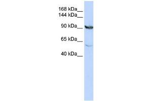 WB Suggested Anti-MTHFD1 Antibody Titration:  0.
