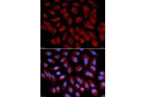 Immunofluorescence analysis of U2OS cell using AIFM1 antibody. (AIF antibody  (AA 334-613))