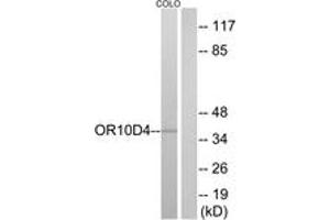 Western blot analysis of extracts from COLO cells, using OR10D4 Antibody. (OR10D4P antibody  (AA 161-210))