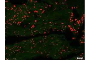 Formalin-fixed and paraffin-embedded human colon carcinoma labeled with Anti-DATF1/IDO1 Polyclonal Antibody, Unconjugatedused at 1:200 dilution for 40 minutes at 37°C (IDO1 antibody  (AA 1-100))