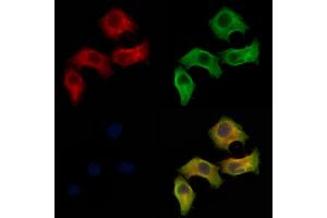 ABIN6262524 and ABIN6278481 staining Hela cells by IF/ICC.
