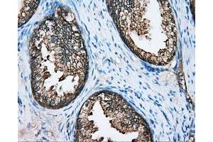 Immunohistochemical staining of paraffin-embedded Kidney tissue using anti-DNTTIP1 mouse monoclonal antibody. (DNTTIP1 antibody)