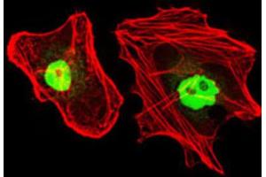 Immunocytochemistry (ICC) image for anti-Replication Protein A1, 70kDa (RPA1) antibody (ABIN1846411) (RPA1 antibody)