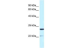 WB Suggested Anti-Yipf5 Antibody   Titration: 1. (YIPF5 antibody  (N-Term))
