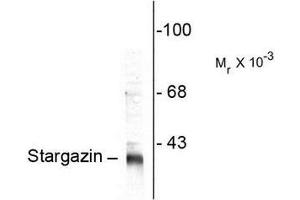 Image no. 1 for anti-Calcium Channel, Voltage-Dependent, gamma Subunit 2 (CACNG2) (C-Term) antibody (ABIN372715) (Stargazin antibody  (C-Term))