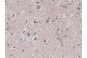 Used in DAB staining on fromalin fixed paraffin-embedded Liver tissue (PGC antibody  (AA 61-388))