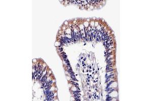 Immunohistochemical analysis of paraffin-embedded H.