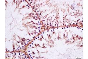 Formalin-fixed and paraffin embedded rat testis labeled with Anti-Cystatin SA Polyclonal Antibody, Unconjugated  at 1:200 followed by conjugation to the secondary antibody and DAB staining. (CST2 antibody  (AA 41-120))