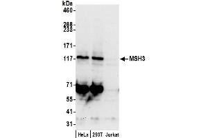 anti-MutS Homolog 3 (MSH3) (AA 1087-1137) antibody