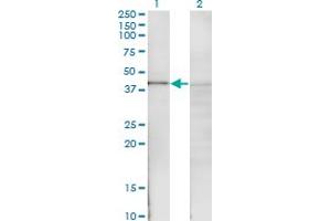 Western Blot analysis of NFKBIB expression in transfected 293T cell line by NFKBIB monoclonal antibody (M06), clone 1G6. (NFKBIB antibody  (AA 1-356))