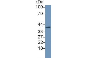 Detection of DHH in Mouse Cerebrum lysate using Polyclonal Antibody to Hedgehog Homolog, Desert (DHH) (desert Hedgehog antibody  (AA 212-392))