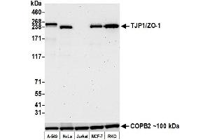 Western Blotting (WB) image for anti-Tight Junction Protein 1 (TJP1) (AA 650-700) antibody (ABIN7453989) (Recombinant TJP1 antibody  (AA 650-700))
