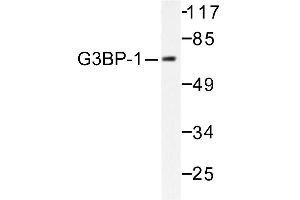 Image no. 1 for anti-GTPase Activating Protein (SH3 Domain) Binding Protein 1 (G3BP1) antibody (ABIN265425) (G3BP1 antibody)