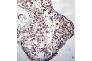 Immunohistochemistry analysis in formalin fixed and paraffin embedded human testis tissue reacted with GLCCI1 Antibody (Center) followed by peroxidase conjugation of the secondary antibody and DAB staining. (GLCCI1 antibody  (Middle Region))