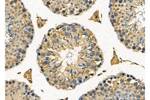 anti-Death-Associated Protein Kinase 2 (DAPK2) (C-Term) antibody