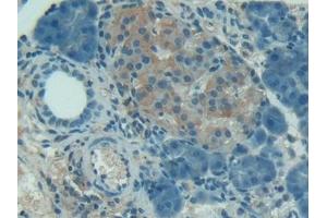 Immunohistochemistry (IHC) image for anti-Serpin Peptidase Inhibitor, Clade G (C1 Inhibitor), Member 1 (SERPING1) (AA 148-270) antibody (ABIN7431434)