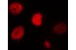 ABIN6274435 staining HT29 cells by IF/ICC. (IPMK antibody  (Internal Region))