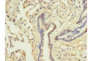 Immunohistochemistry of paraffin-embedded human lung tissue using ABIN7144990 at dilution of 1:100 (DDX42 antibody  (AA 519-819))